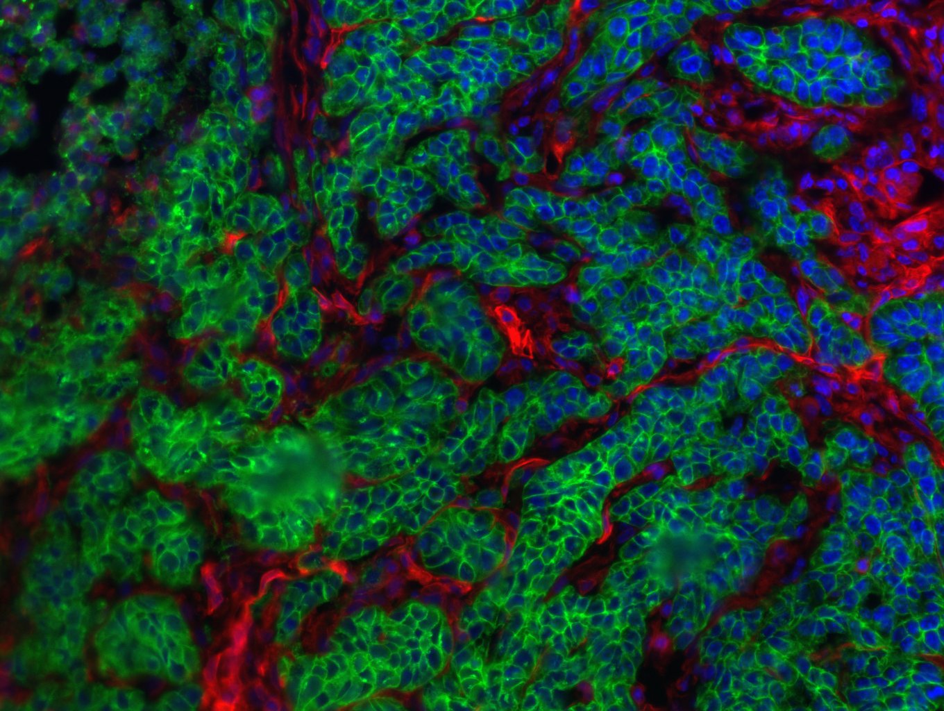 Cancer du foie : l’environnement cellulaire joue un rôle dans l’évolution de la tumeur hépatique
