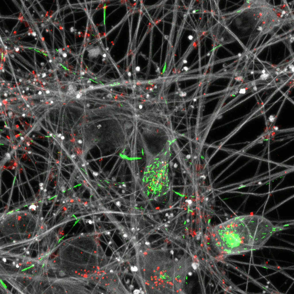 Des réseaux de neurones humains pour modéliser la maladie de Parkinson
