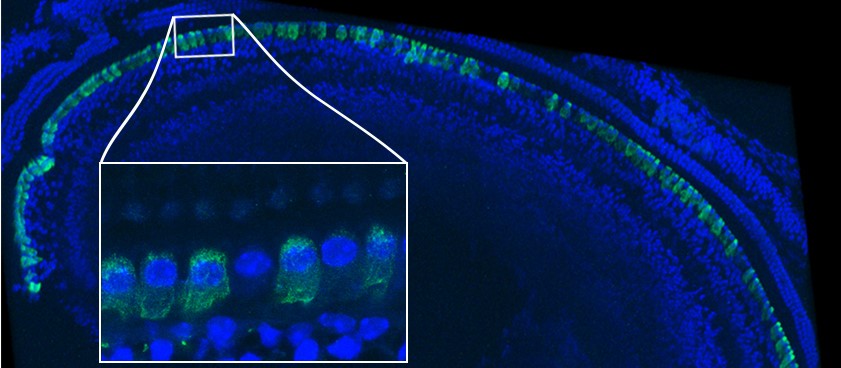 Gene therapy durably reverses congenital deafness in mice