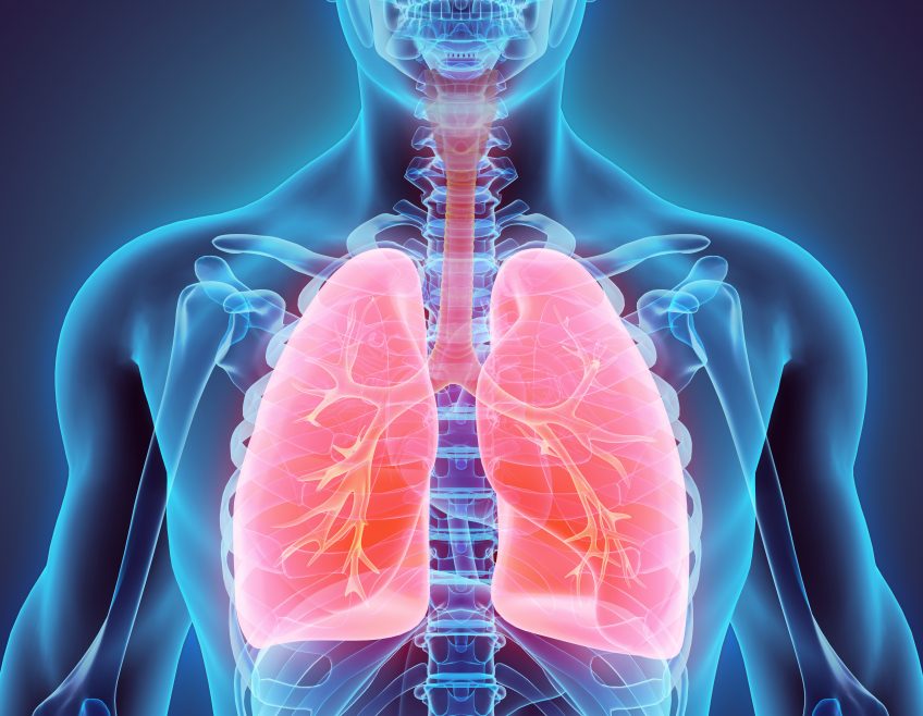 Cancer du poumon métastatique : une thérapie ciblée pour améliorer ...