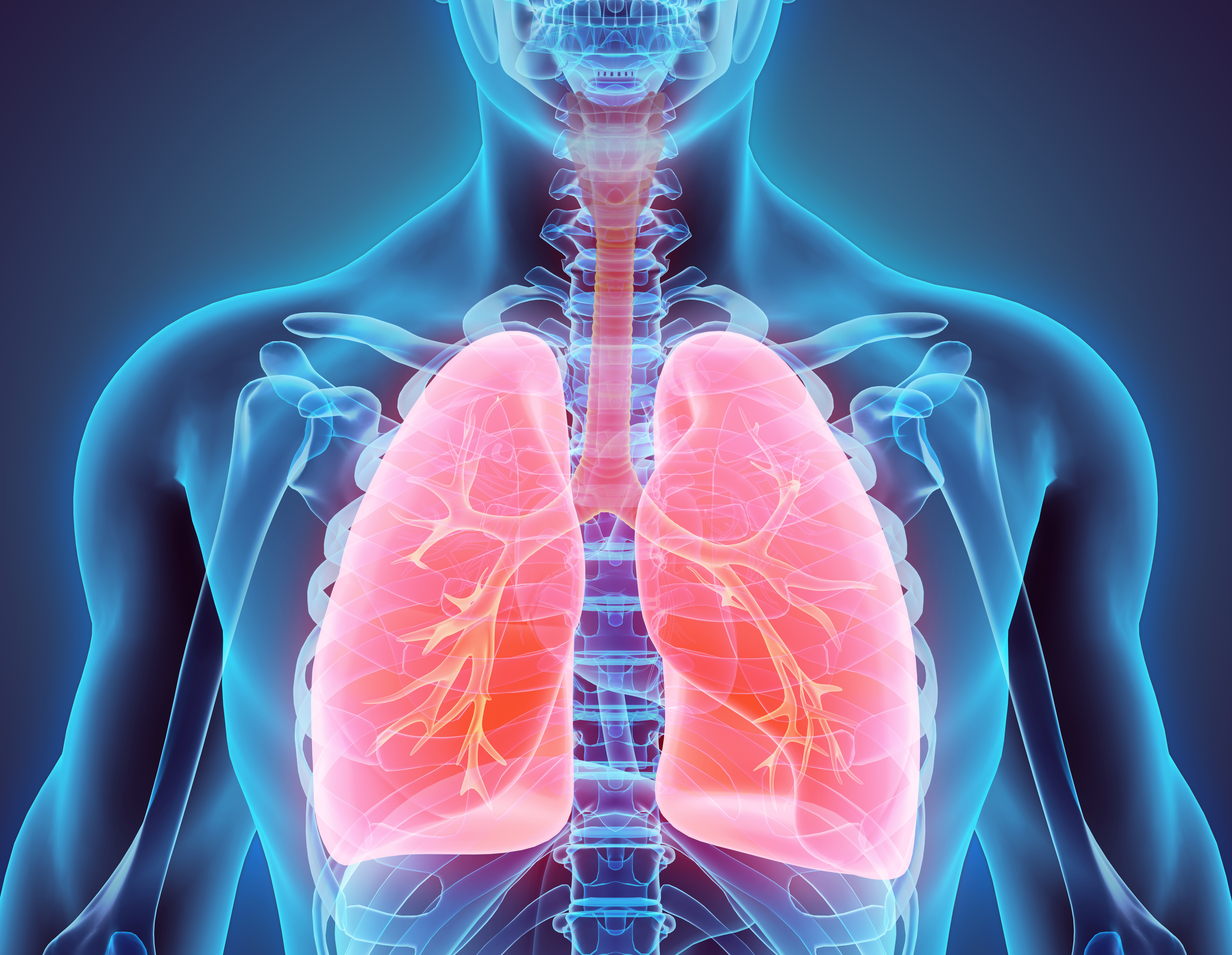 Cancer du poumon métastatique : une thérapie ciblée pour améliorer l’efficacité du traitement