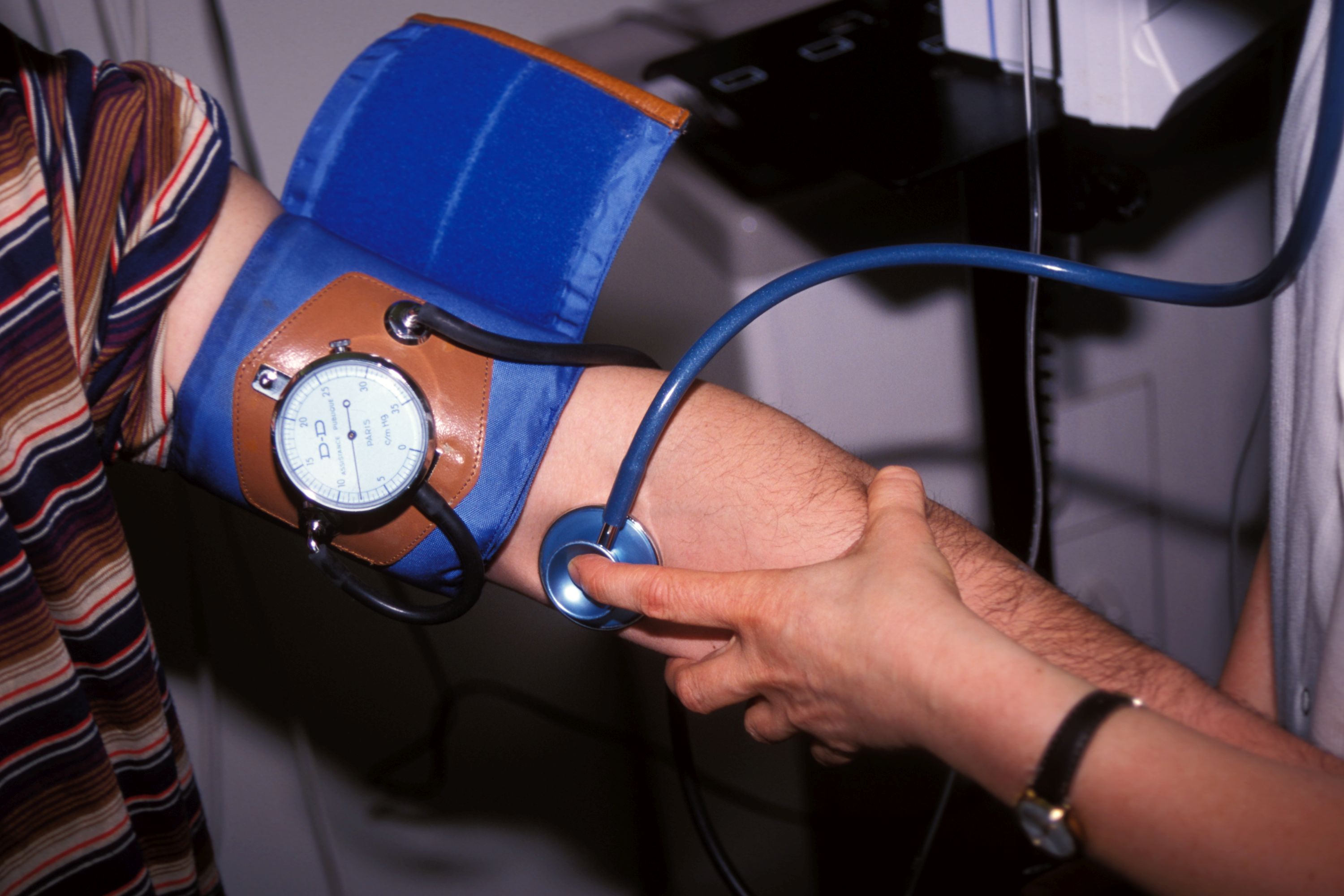 Hypertension artérielle: le bénéfice d’une thérapie par ultrasons montré