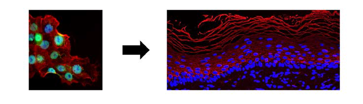 Skin graft: a new molecular target for activating stem cells - Inserm ...