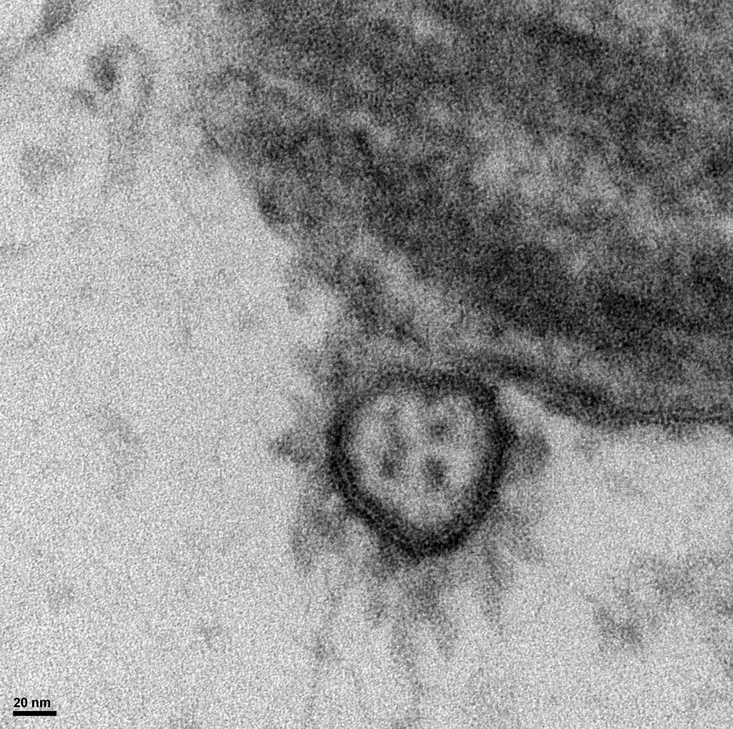 Un virus créé en laboratoire, vraiment ?