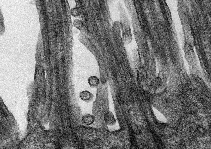 Image de microscopie du Coronavirus SARS-CoV-2 responsables de la maladie COVID-19 accrochés aux cellules épithéliales respiratoires humaines