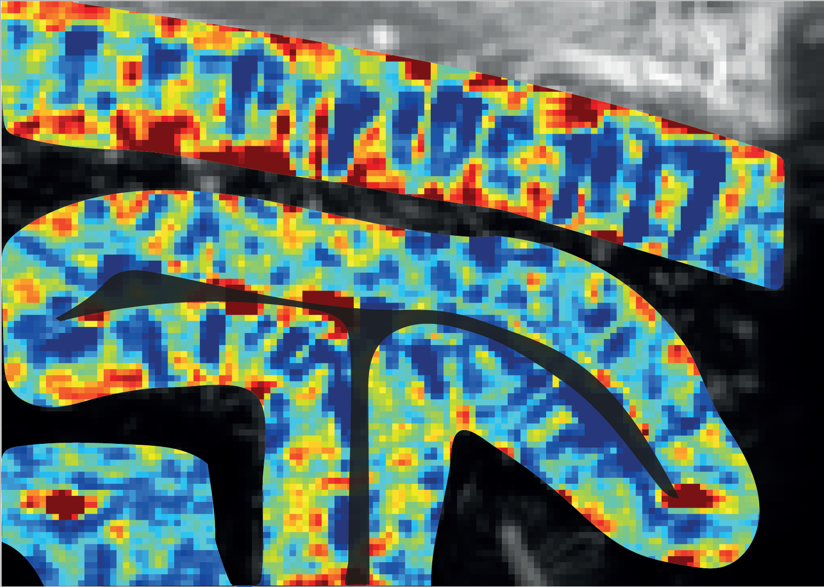 L’imagerie ultrasonore pour résoudre le fonctionnement du cortex visuel