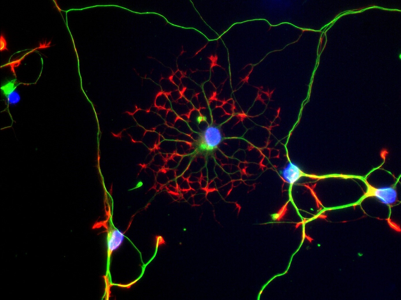 Des cellules cérébrales en forme d’étoile éclairent le lien entre consommation de cannabis et sociabilité