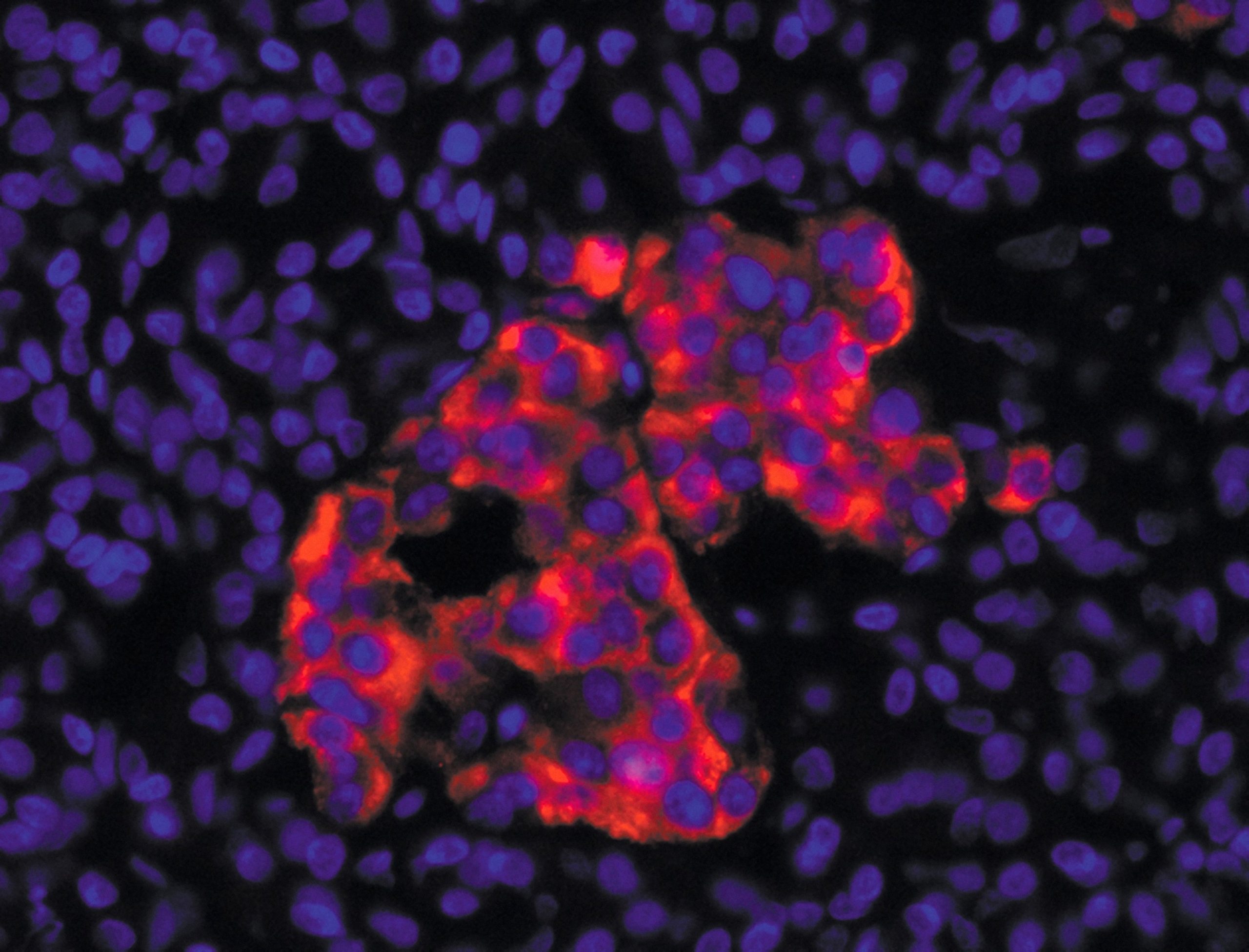 Cellules β pancréatiques humaines produisant l’insuline (en rouge). L’ADN des cellules est marqué en bleu.