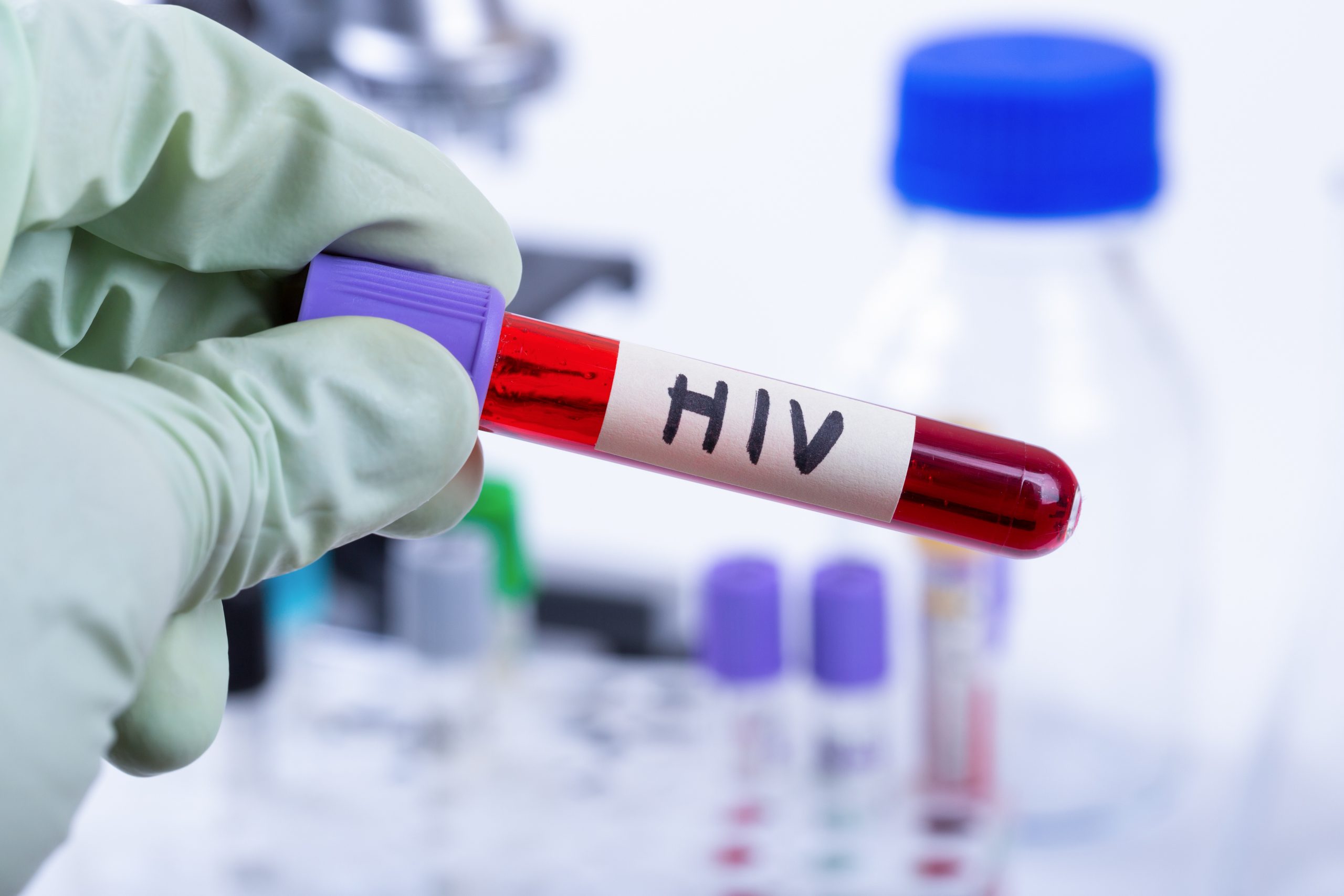 Efficacité de traitement contre le VIH : le dolutégravir n’est pas inférieur à l’éfavirenz au terme de 96 semaines d’étude
