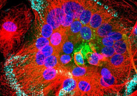 Macrophages infectés par le VIH : Les protéines virales sont en vert, les microtubules en rouge et les noyaux en bleu. Taille des noyaux : 5µm © Inserm/Institut Curie, R. Gaudin/P. Bernaroch