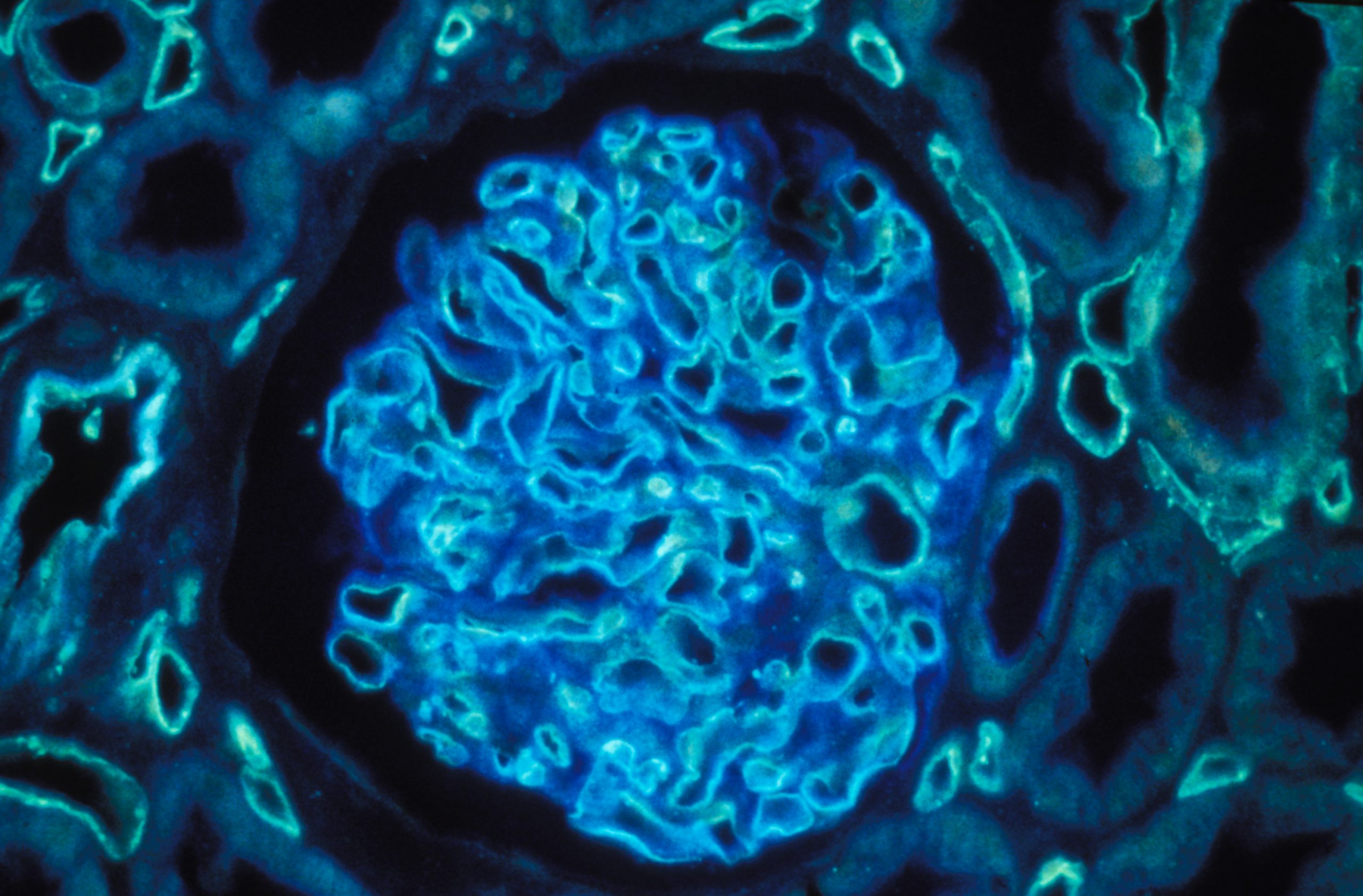 Coupe de rein humain grossie 400 fois par un microscope à immunofluorescence polychromatique