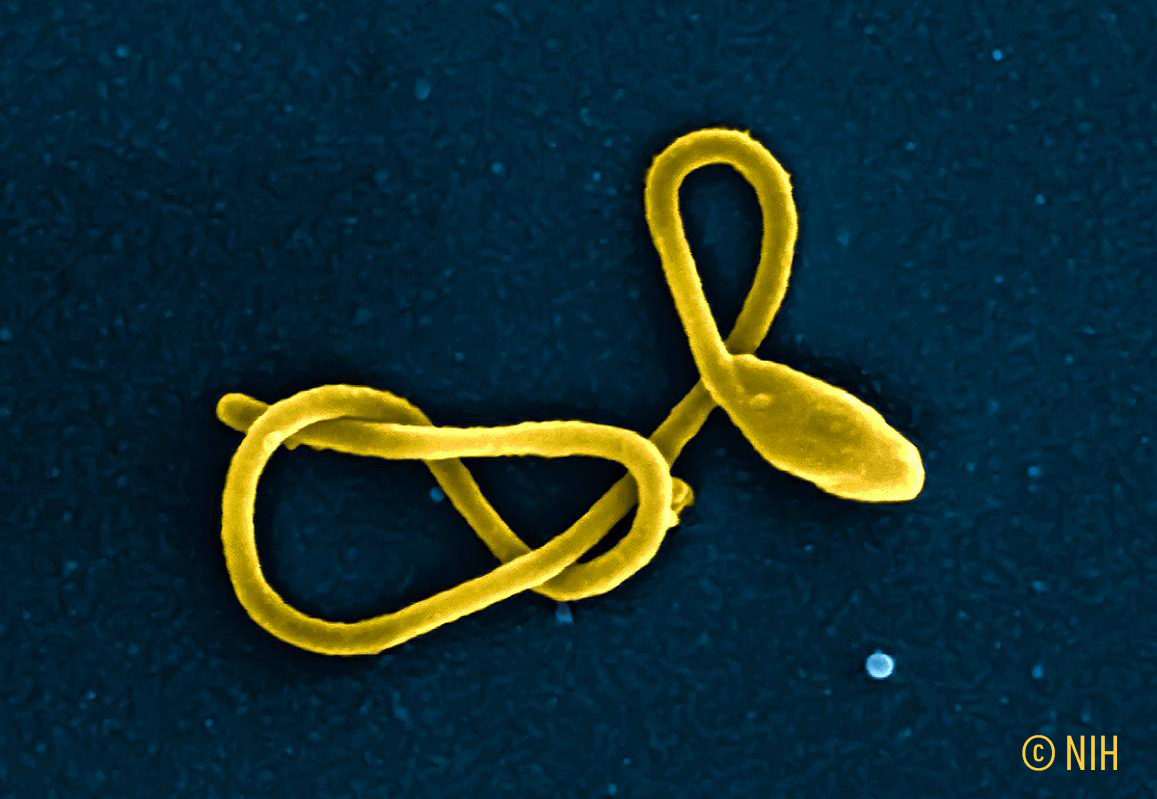 Suivi des survivants d’Ebola après cinq ans : de nouvelles données sur la durée de l’immunité et la persistance du virus