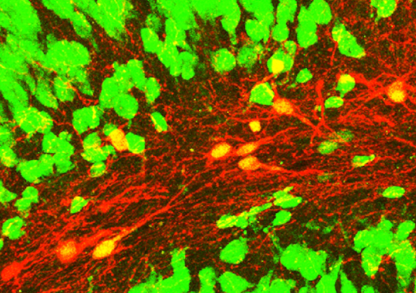 Regenerating Lost Neurons: A Successful Bet for Research