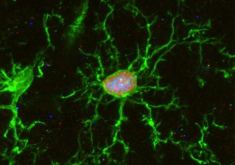 Cellule microgliale