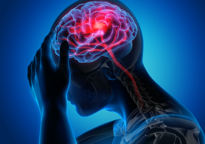 Increased Ischemic Stroke Risk Associated with Certain Medications for Nausea and Vomiting