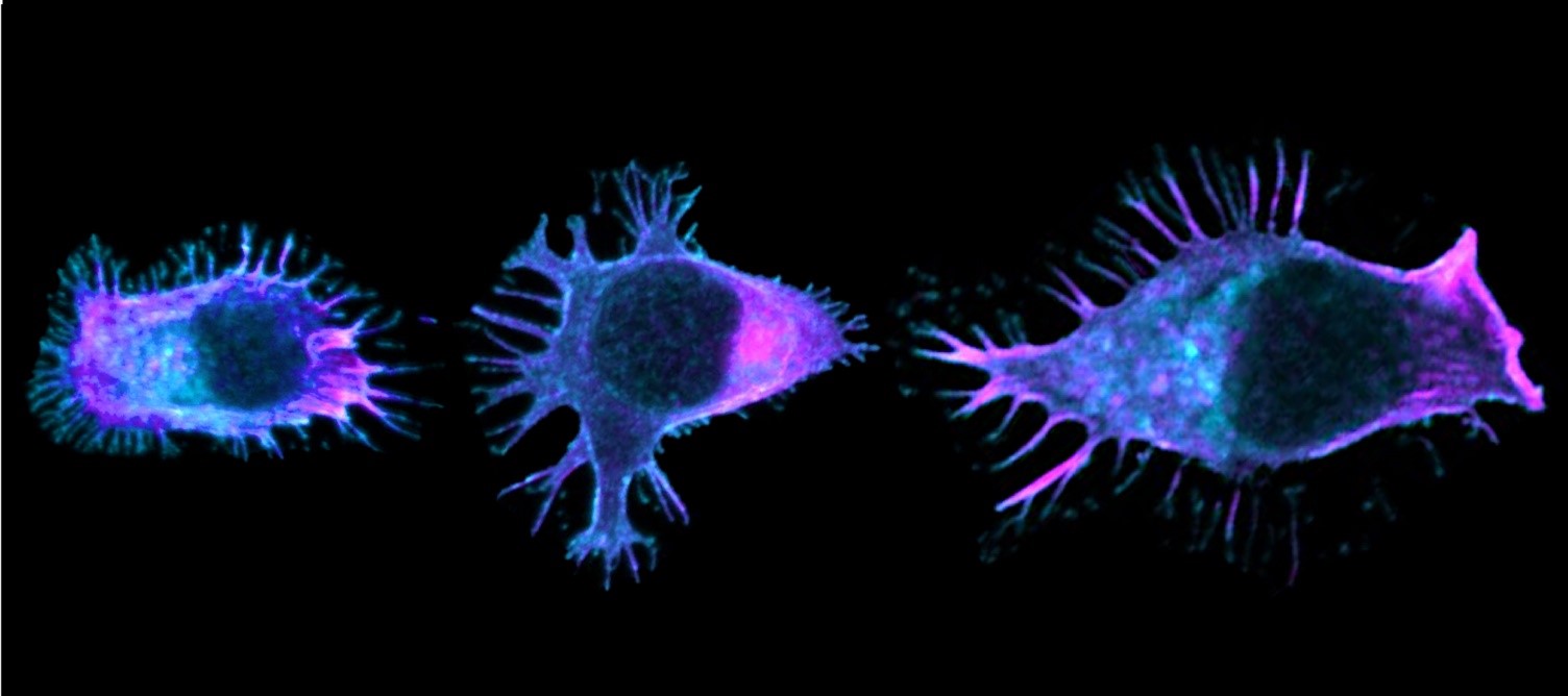 Cancer du côlon : comment la mutation du gène APC perturbe la migration des lymphocytes
