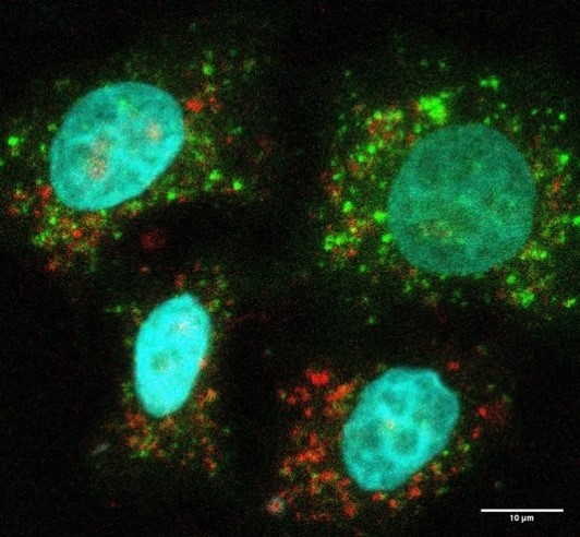 Production de nanoparticules délétères pour l’hôte par les bactéries responsables de sepsis