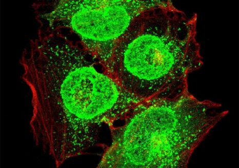Cellules épithéliales respiratoires humaines (en rouge) infectées par un virus grippal (en vert). 