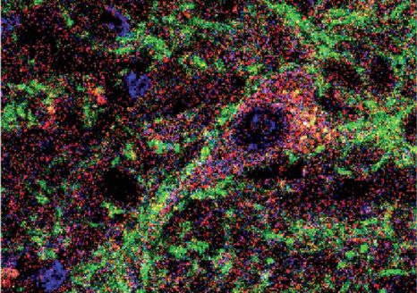 Neurone du cervelet (en rouge) projetant vers le site de genèse des mouvements involontaires dans la maladie de Parkinson. La stimulation intermittente des terminaisons nerveuses (en vert) dans un modèle de Parkinson chez la souris prévient l’apparition de ces mouvements