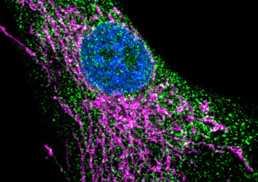 Image microscopique d’un fibroblaste de peau