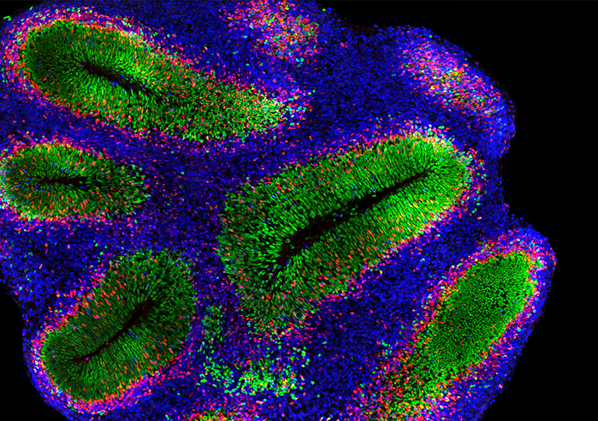 Organoïde cortical au stade 8 semaines © Alexandre Baffet, Institut Curie