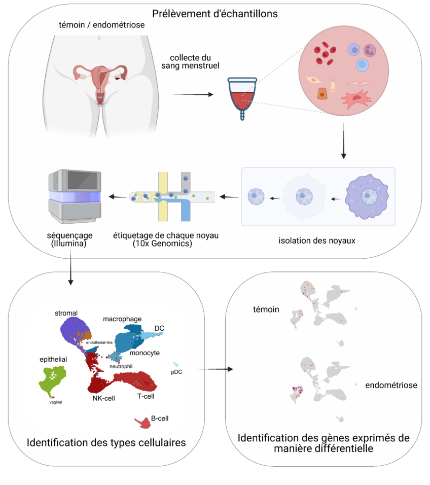 L'image présente de façon schématique les différentes étapes d'une partie de la méthodologie des travaux de recherche décrite plus amplement dans le texte. : des échantillons de sang menstruel sont récupérés auprès de personnes atteintes d'endométriose et de personnes témoin, utilisatrices de cup menstruelle,. Les noyaux des cellules sanguines sont isolés avant d'être étiquetés un par un par une technique spécifique et d'être ensuite séquencé. Le séquençage permet alors d'identifier les différents types cellulaires - stromal, épithélial, endothélial, cellules immunitaires (macrophages, monocytes, neutrophiles, lymphocytes T, cellules NK, cellules dendritiques). Enfin, les gènes exprimés de manière différentielle entre les personnes témoins et celles atteintes d'endométriose sont identifiés dans kes différents types cellulaires.