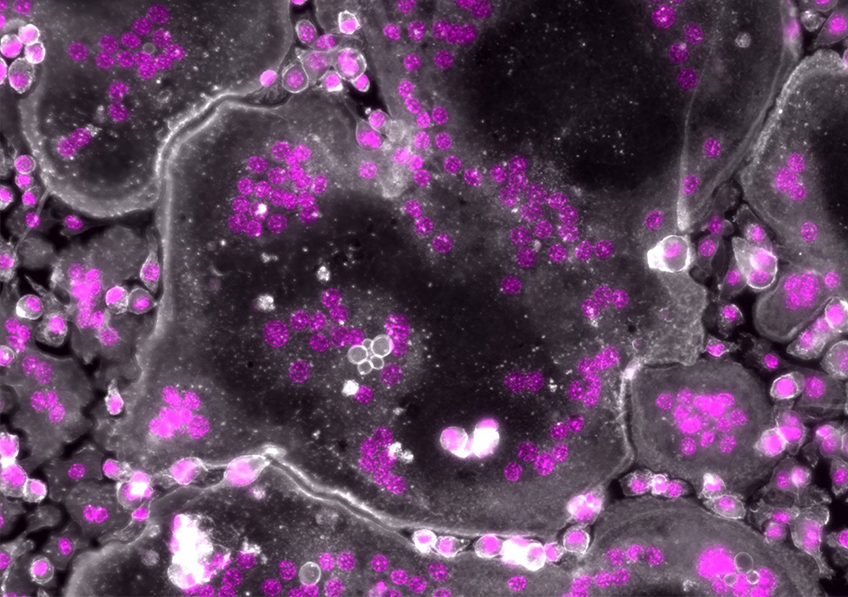 Vieillissement, maladies et cancer de l’os : la moésine, une molécule qui pèse dans la balance