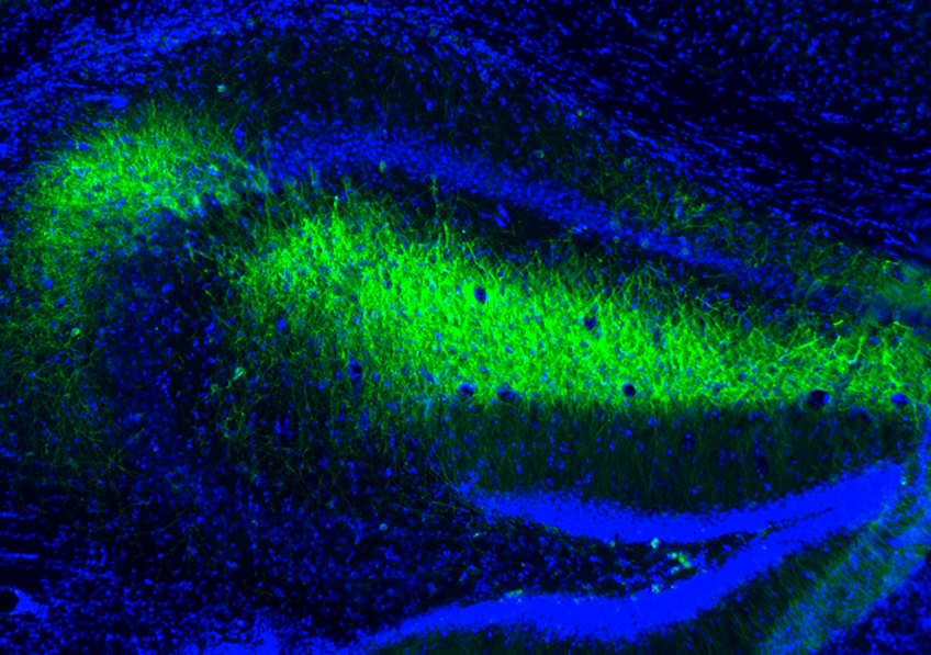 L’expression et l’activation de mitoDREADD-Gs (ici coloré en vert) dans l’hippocampe permet d’y augmenter l’activité mitochondriale et de restaurer la mémoire chez des modèles murins de démence.