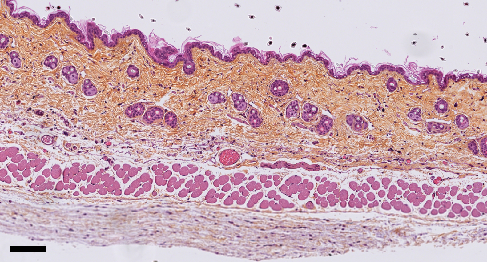 Masser la peau pour vacciner : une alternative possible aux injections ?